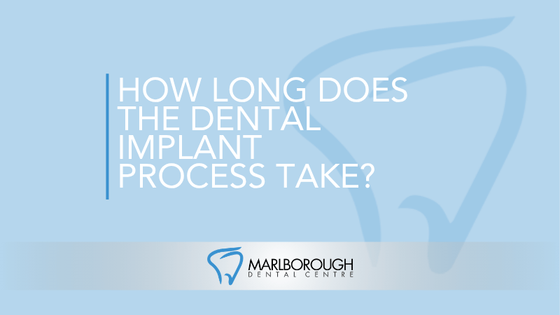 How Long Does the Dental Implant Process Take?